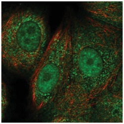 Rad51C Antibody, Novus Biologicals 100&mu;L; Unlabeled:Antibodies, Polyclonal