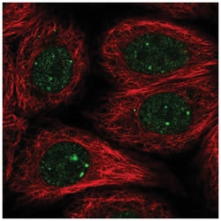 Rad51L1 Antibody, Novus Biologicals 25 &mu;L:Antibodies, Polyclonal