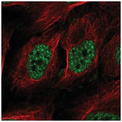 RAD52 Antibody, Novus Biologicals 100&mu;L; Unlabeled:Antibodies, Polyclonal