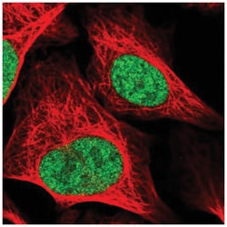 RAD54L Antibody, Novus Biologicals:Antibodies:Primary Antibodies
