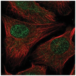 RAD54L2 Antibody, Novus Biologicals 100 &mu;L | Buy Online | Novus Biologicals | Fisher Scientific