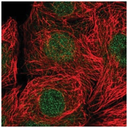Rad9 Antibody, Novus Biologicals 100&mu;L; Unlabeled:Antibodies, Polyclonal