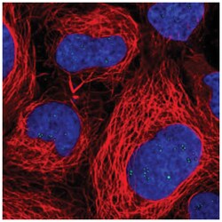 RAE1 Antibody, Novus Biologicals 25 &mu;L, Unlabeled:Antibodies, Polyclonal