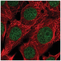 RAI1 Antibody, Novus Biologicals 25 &mu;L, Unlabeled:Antibodies, Polyclonal
