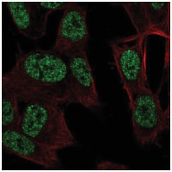 RALYL Antibody, Novus Biologicals 100&mu;L; Unlabeled:Antibodies, Polyclonal