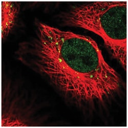 RANBP6 Antibody, Novus Biologicals 100&mu;L; Unlabeled:Antibodies, Polyclonal