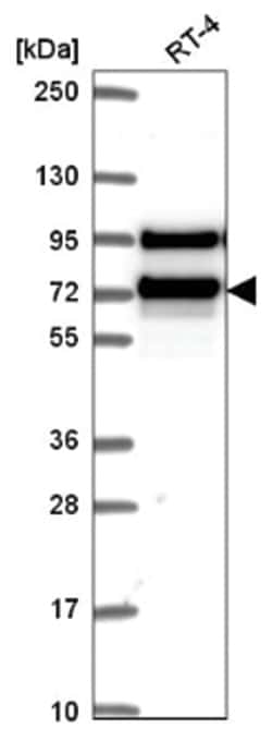 RanGAP1 Antibody, Novus Biologicals 100&mu;L; Unlabeled:Antibodies, Polyclonal