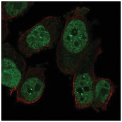 RAPGEF5 Antibody, Novus Biologicals 100&mu;L; Unlabeled:Antibodies, Polyclonal