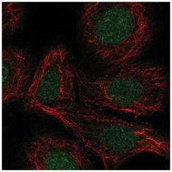 RAR alpha/NR1B1 Antibody, Novus Biologicals:Antibodies:Primary Antibodies