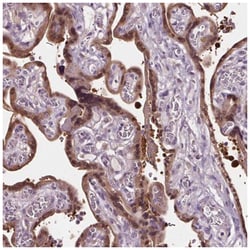 Ras-GAP Antibody, Novus Biologicals:Antibodies:Primary Antibodies