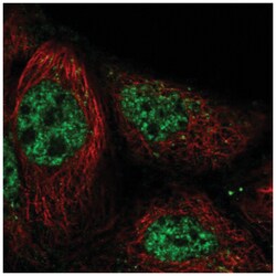 RASGRP3 Antibody, Novus Biologicals 25 &mu;L, Unlabeled:Antibodies, Polyclonal