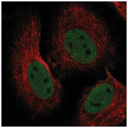 RBBP4/RbAp48 Antibody, Novus Biologicals 100&mu;L; Unlabeled:Anticorps,
