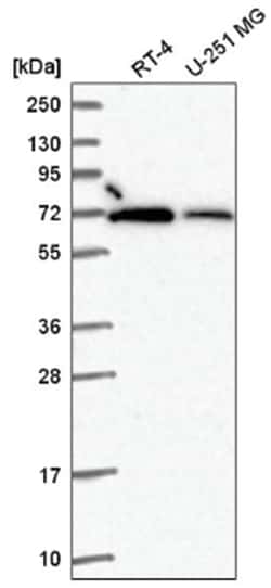 RbBP5 Antibody, Novus Biologicals 25 &mu;L:Antibodies, Polyclonal