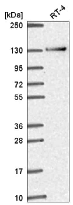 RBM10 Antibody, Novus Biologicals 25 &mu;L, Unlabeled:Antibodies, Polyclonal