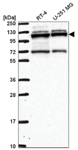 RBM15 Antibody, Novus Biologicals:Antibodies:Primary Antibodies