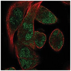 RBM24 Antibody, Novus Biologicals 25 &mu;L, Unlabeled:Antibodies, Polyclonal