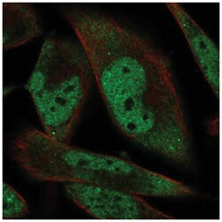 RBM24 Antibody, Novus Biologicals 100&mu;L; Unlabeled:Antibodies, Polyclonal