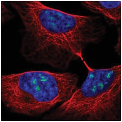 RBM28 Antibody, Novus Biologicals:Antibodies:Primary Antibodies