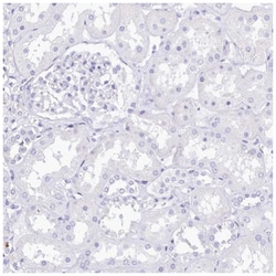 RBP3 Antibody, Novus Biologicals 100&mu;L; Unlabeled:Antibodies, Polyclonal