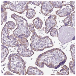 RBP3 Antibody, Novus Biologicals 25 &mu;L, Unlabeled:Antibodies, Polyclonal