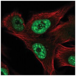 RCAN3 Antibody, Novus Biologicals 100 &mu;L | Buy Online | Novus Biologicals | Fisher Scientific