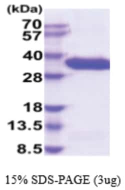 Novus Biologicals&trade;&nbsp;Recombinant Human Complement Factor B His Protein