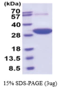 Novus Biologicals&trade;&nbsp;Recombinant Human DCXR His Protein