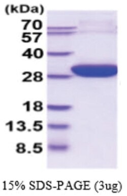 Novus Biologicals&trade;&nbsp;Recombinant Human ECHS1 Protein