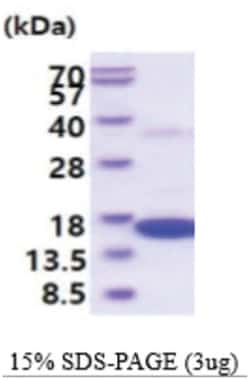 Novus Biologicals Recombinant Mouse IFN-gamma His Protein 100 &mu;g | Buy Online | Novus Biologicals&trade; | Fisher Scientific