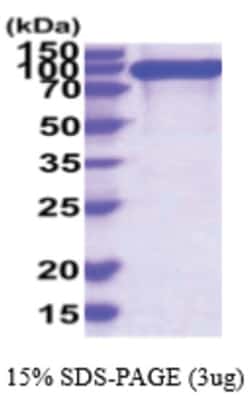 Novus Biologicals Recombinant Human Integrin beta 1/CD29 Protein 50 &mu;g | Buy Online | Novus Biologicals&trade; | Fisher Scientific