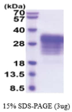 Novus Biologicals Recombinant Human LIF Protein 50 &mu;g | Buy Online | Novus Biologicals&trade; | Fisher Scientific