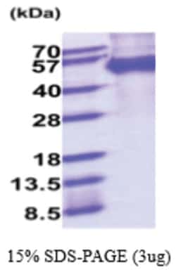 Novus Biologicals Recombinant Mouse MFG-E8 His Protein 10 &mu;g | Buy Online | Novus Biologicals&trade; | Fisher Scientific