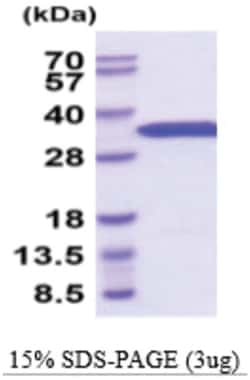 Novus Biologicals&trade;&nbsp;Recombinant Mouse eIF4E Protein