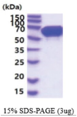 Novus Biologicals&trade;&nbsp;Recombinant Mouse STI1 His Protein