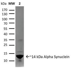 Novus Biologicals™ Recombinant Human alpha-Synuclein Aggregate Protein (Biologically Active)