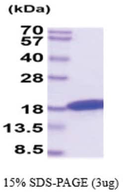 Novus Biologicals Recombinant Feline IFN-gamma His Protein 50 &mu;g | Buy Online | Novus Biologicals&trade; | Fisher Scientific