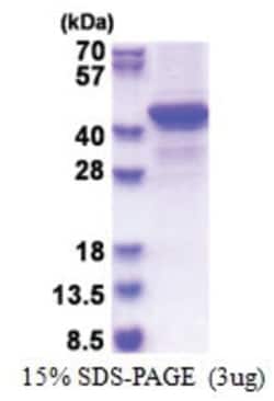 Novus Biologicals&trade;&nbsp;Recombinant Human Bestrophin 1 Protein