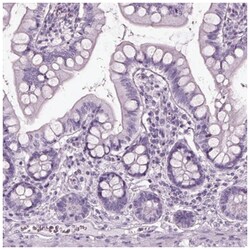 Recoverin Antibody, Novus Biologicals 25 &mu;L, Unlabeled:Antibodies, Polyclonal