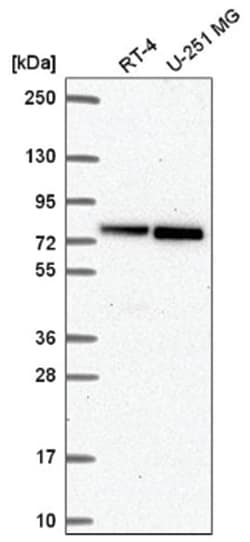 RECQ1 Antibody, Novus Biologicals 100&mu;L; Unlabeled:Antibodies, Polyclonal