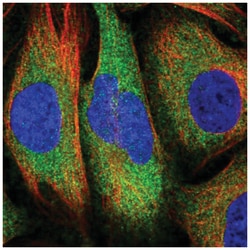 RelA/NFkB p65 Antibody, Novus Biologicals 25 &mu;L:Antibodies, Polyclonal