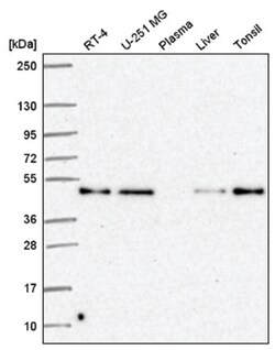 RELT/TNFRSF19L Antibody, Novus Biologicals 25 &mu;L, Unlabeled:Antibodies,