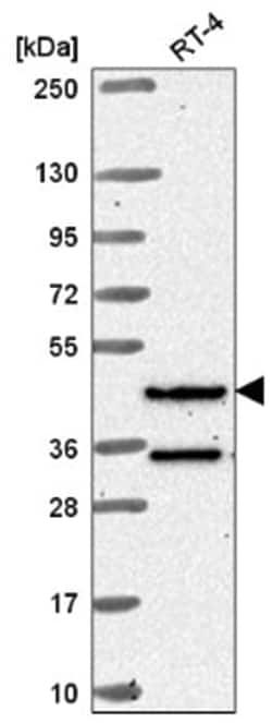 RFX8 Antibody, Novus Biologicals 25 &mu;L, Unlabeled:Antibodies, Polyclonal