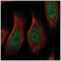 RGM-A Antibody, Novus Biologicals 100&mu;L; Unlabeled:Antibodies, Polyclonal