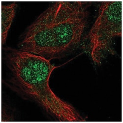 RGS12 Antibody, Novus Biologicals 25 &mu;L:Antibodies, Polyclonal