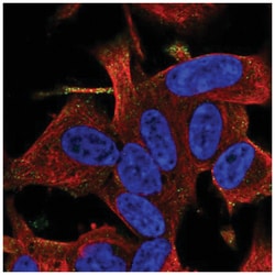 RGS17 Antibody, Novus Biologicals 25 &mu;L, Unlabeled:Antibodies, Polyclonal