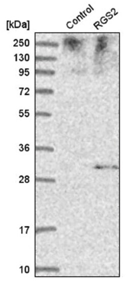 RGS2 Antibody, Novus Biologicals 100&mu;L; Unlabeled:Antibodies, Polyclonal