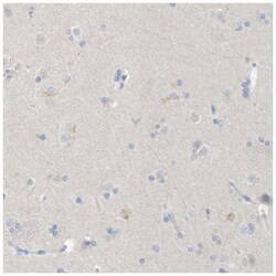 RGS9 Antibody, Novus Biologicals 25 &mu;L, Unlabeled:Antibodies, Polyclonal