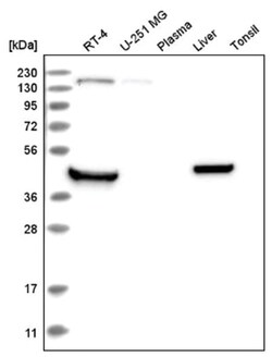 RHBDL1 Antibody, Novus Biologicals 100&mu;L; Unlabeled:Antibodies, Polyclonal
