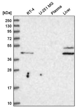 RHBG Antibody, Novus Biologicals 100&mu;L; Unlabeled:Antibodies, Polyclonal