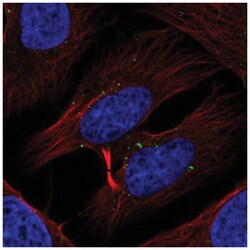 RLK/TXK Antibody, Novus Biologicals 25 &mu;L, Unlabeled:Antibodies, Polyclonal